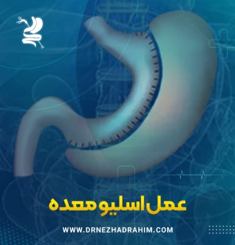 عمل اسلیو معده ✔️ دکتر احمد نژاد رحیم