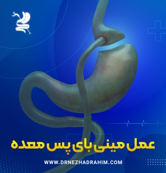 عمل مینی بای پس معده ✔️ دکتر احمد نژاد رحیم
